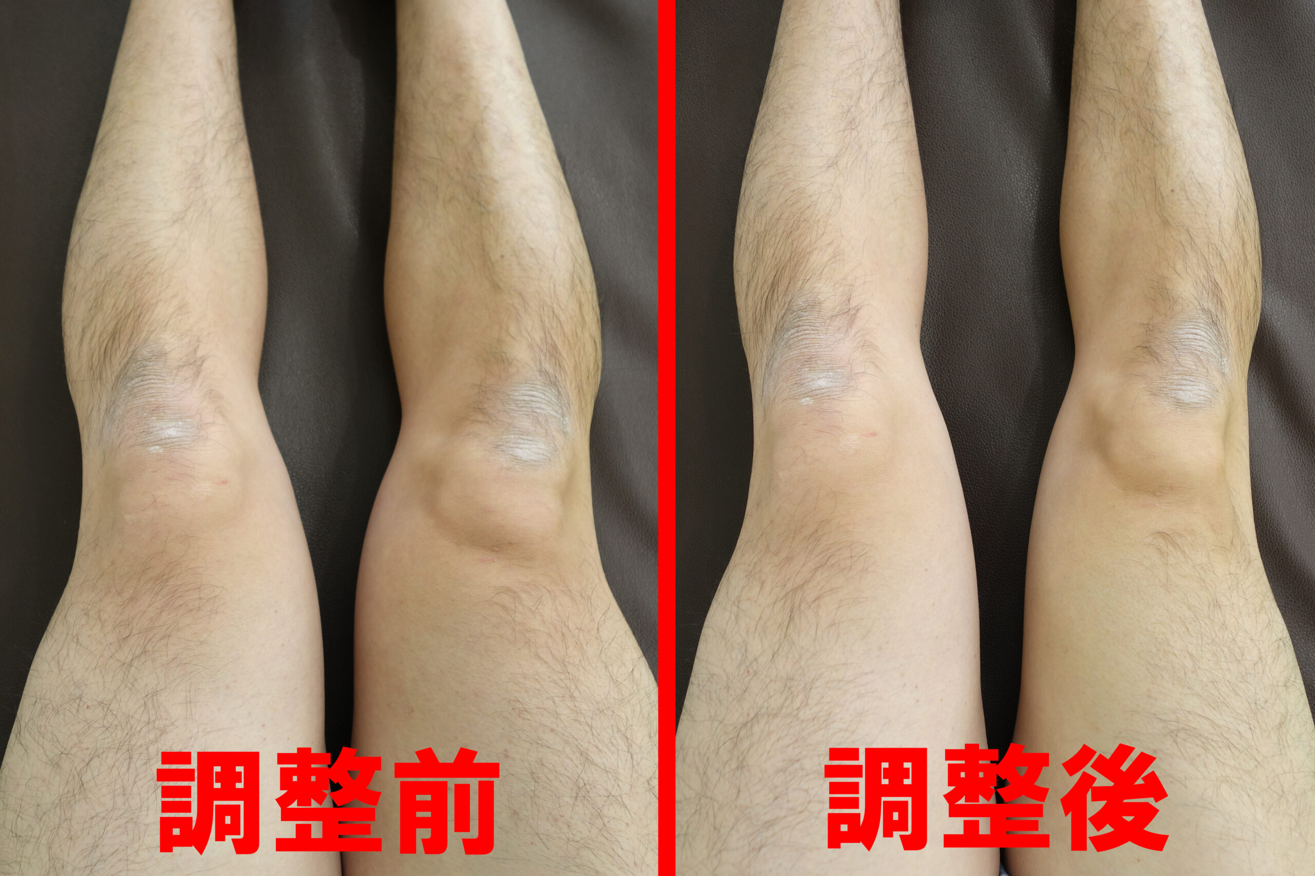 膝周りの循環を改善した前後の画像を比較